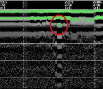 Imagen de georadar de un tesoro encontrado en tlaxcala